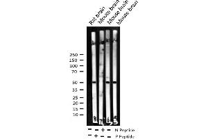 ATF2 抗体  (pThr51, pThr69)