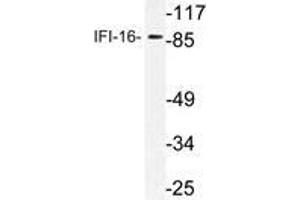 Western blot (WB) analysis of IFI-16 antibody in extracts from HepG2 cells. (IFI16 抗体)