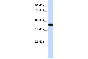 WB Suggested Anti-HMOX1 Antibody Titration: 0. (HMOX1 抗体  (N-Term))