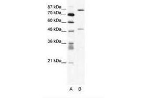 Image no. 1 for anti-Matrix Metallopeptidase 10 (Stromelysin 2) (MMP10) (N-Term) antibody (ABIN202622) (MMP10 抗体  (N-Term))