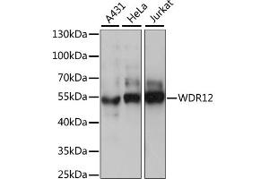 Western blot analysis of extracts of various cell lines, using WDR12 antibody. (WDR12 抗体)