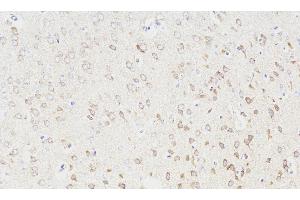 Immunohistochemistry analysis of paraffin-embedded Rat brain using NOS1 Polyclonal Antibody at dilution of 1:300. (NOS1 抗体)