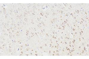 Immunohistochemistry analysis of paraffin-embedded Rat brain using NOS1 Polyclonal Antibody at dilution of 1:300. (NOS1 抗体)