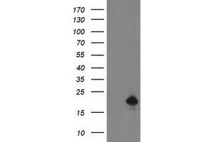 HEK293T cells were transfected with the pCMV6-ENTRY control (Left lane) or pCMV6-ENTRY DSTN (Right lane) cDNA for 48 hrs and lysed. (Destrin 抗体)