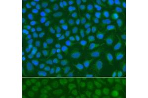 Immunofluorescence analysis of A549 cells using SSX5 Polyclonal Antibody (SSX5 抗体)