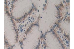 IHC-P analysis of Human Stomach Tissue, with DAB staining. (CSF2RA 抗体  (AA 204-360))