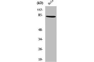 Western Blot analysis of HeLa cells using ZNF225 Polyclonal Antibody (ZNF225 抗体  (C-Term))