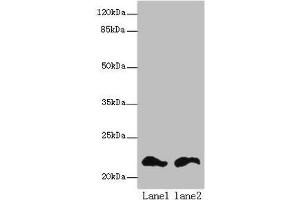 Western blot All lanes: FKBP11 antibody at 6 μg/mL Lane 1: Mouse spleen tissue Lane 2: Mouse liver tissue Secondary Goat polyclonal to rabbit IgG at 1/10000 dilution Predicted band size: 23, 16 kDa Observed band size: 23 kDa (FKBP11 抗体  (AA 28-154))