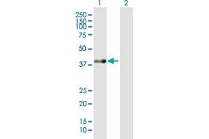 Western Blot analysis of ACAT2 expression in transfected 293T cell line by ACAT2 MaxPab polyclonal antibody. (ACAT2 抗体  (AA 1-397))