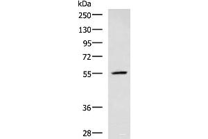 Western blot analysis of A549 cell lysate using CEP57 Polyclonal Antibody at dilution of 1:600 (CEP57 抗体)