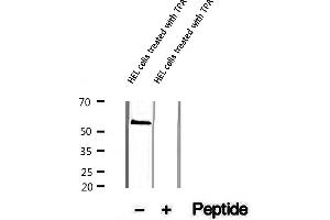 Western blot analysis of extracts of HEL cells treated with TPA, using Phospho-AML1 (Ser249) Antibody.