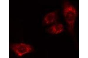 ABIN6275534 staining HeLa cells by IF/ICC. (PLK2 抗体  (Internal Region))