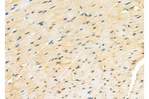 ABIN6264469 and ABIN6277231 at 1/100 staining Rat heart tissue by IHC-P.