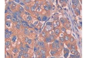 Immunohistochemistry (IHC) image for anti-Complement Factor B (CFB) (AA 35-160) antibody (ABIN1858372)