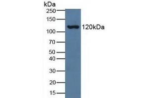 Detection of C3a in Human Serum using Polyclonal Antibody to Complement Component 3a (C3a) (C3a 抗体  (AA 672-748))