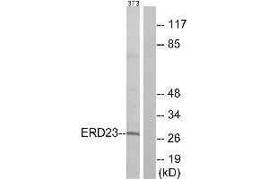Western blot analysis of extracts from NIH/3T3 cells, using ERD23 antibody. (KDELR3 抗体  (Internal Region))