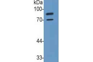 Rabbit Capture antibody from the kit in WB with Positive Control: Sample Human U937 Cells. (Integrin beta 2 ELISA 试剂盒)