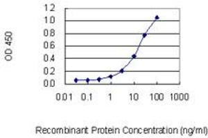 Detection limit for recombinant GST tagged TCOF1 is 0. (TCOF1 抗体  (AA 2-82))