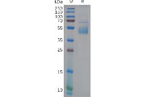 Human GP1BB Protein, hFc Tag on SDS-PAGE under reducing condition.