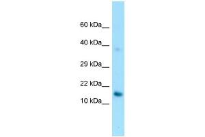 WB Suggested Anti-GPIHBP1 Antibody Titration: 1. (GPIHBP1 抗体  (C-Term))