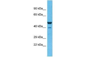 Host:  Rabbit  Target Name:  ZNF589  Sample Type:  Lung Tumor lysates  Antibody Dilution:  1. (ZNF589 抗体  (C-Term))