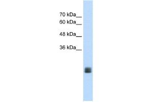 WB Suggested Anti-MGC33926 Antibody Titration:  1. (TMEM178 抗体  (Middle Region))