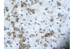 Immunohistochemistry (IHC) image for anti-Capicua Homolog (CIC) (N-Term) antibody (ABIN2779683)