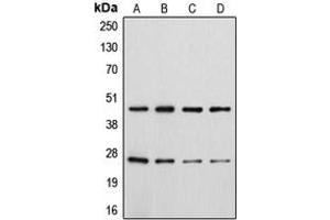 Western blot analysis of CD28 (pY218) expression in HeLa colchicine-treated (A), Jurkat (B), Raw264. (CD28 抗体  (C-Term, pTyr218))