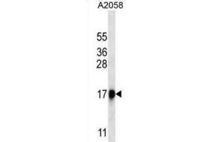 Western Blotting (WB) image for anti-Chymotrypsin-Like Elastase Family, Member 1 (CELA1) antibody (ABIN2999709) (CELA1 抗体)