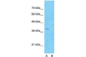 Host:  Rabbit  Target Name:  CYTB  Sample Type:  MCF7  Lane A:  Primary Antibody  Lane B:  Primary Antibody + Blocking Peptide  Primary Antibody Concentration:  1ug/ml  Peptide Concentration:  5ug/ml  Lysate Quantity:  25ug/lane/lane  Gel Concentration:  0. (Cytochrome b 抗体  (N-Term))