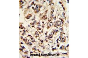 Immunohistochemistry (Paraffin-embedded Sections) (IHC (p)) image for anti-ATPase, H+ Transporting, Lysosomal 70kDa, V1 Subunit A (ATP6V1A) (AA 447-477), (Middle Region) antibody (ABIN950568)