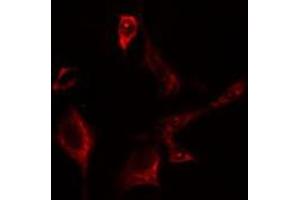 ABIN6275642 staining Hela cells by IF/ICC. (EIF2B3 抗体  (Internal Region))