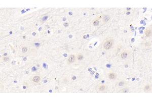 Detection of XRN1 in Human Cerebrum Tissue using Polyclonal Antibody to 5'-3'Exoribonuclease 1 (XRN1)