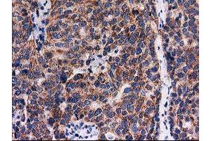 Image no. 4 for anti-Family with Sequence Similarity 127, Member C (FAM127C) antibody (ABIN1498197) (FAM127C 抗体)