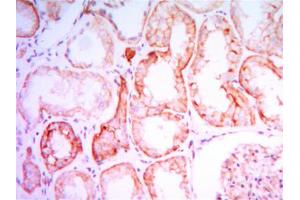 Immunohistochemical analysis of paraffin-embedded human kidney tissues using PTH1R mouse mAb with DAB staining. (PTH1R 抗体)