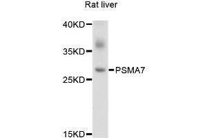 Western blot analysis of extracts of Rat liver cells, using PSMA7 antibody. (PSMA7 抗体)