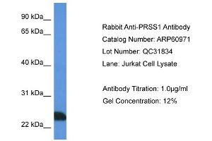 Western Blotting (WB) image for anti-Protease, serine, 1 (Trypsin 1) (PRSS1) (N-Term) antibody (ABIN2788638) (PRSS1 抗体  (N-Term))