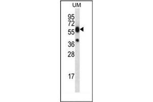 Western blot analysis of LIPM Antibody (C-term) in UM cell line lysates (35ug/lane).