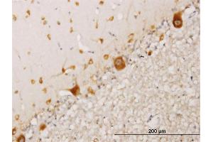 Immunoperoxidase of monoclonal antibody to RPS17 on formalin-fixed paraffin-embedded human cerebellum. (RPS17 抗体  (AA 36-135))