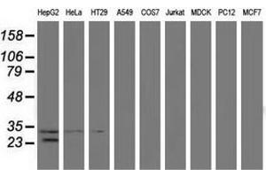 Western blot analysis of extracts (35 µg) from 9 different cell lines by using anti-GSTT2 monoclonal antibody. (GSTT2 抗体)