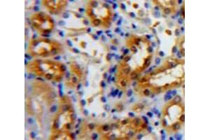 IHC-P analysis of Kidney tissue, with DAB staining. (NR3C2 抗体  (AA 739-984))