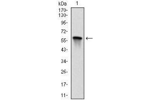 Western blot analysis using MAP2K7 mAb against human MAP2K7 (AA: 7-178) recombinant protein. (MAP2K7 抗体)