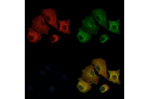 ABIN6257339 and ABIN6275521 staining  cells by IF/ICC.