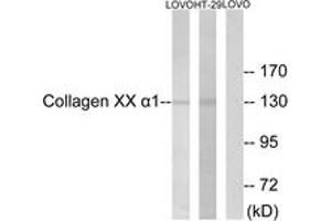 Western Blotting (WB) image for anti-Collagen, Type XX, alpha 1 (COL20A1) (AA 1151-1200) antibody (ABIN1534360)