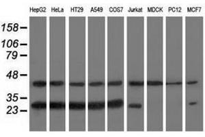 Image no. 2 for anti-RAB, Member of RAS Oncogene Family-Like 2A (RABL2A) antibody (ABIN1500577) (RABL2A 抗体)