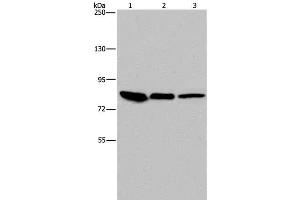Western Blot analysis of Mouse skin tissue, HUVEC and Hela cell using Catenin gamma Polyclonal Antibody at dilution of 1:850 (JUP 抗体)