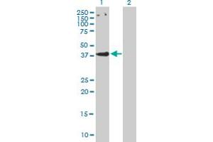 Western Blot analysis of CCBP2 expression in transfected 293T cell line by CCBP2 MaxPab polyclonal antibody. (CCBP2 抗体  (AA 1-384))