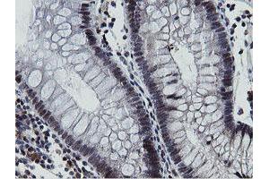 Image no. 10 for anti-Mitochondrial Intermediate Peptidase (MIPEP) (AA 174-516) antibody (ABIN1491016)