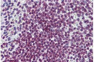 Human Spleen: Formalin-Fixed, Paraffin-Embedded (FFPE) (FOXO3 抗体  (AA 361-460))