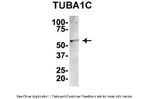 IP Suggested AntiTUBA1C Antibody Positive Control: NT2 CELL/BRAIN TISSUE (TUBA1C 抗体  (C-Term))